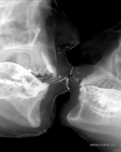 Рентгеновкое излучение в искусстве. (21 фото)